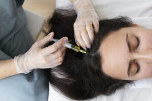 best hair treatment in hyderabad