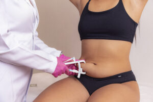 Liposuction surgery in hyderabad