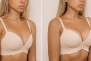 best breast augmentation surgery