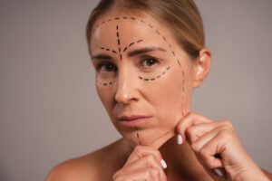 Best Facelift Treatment in Hyderabad