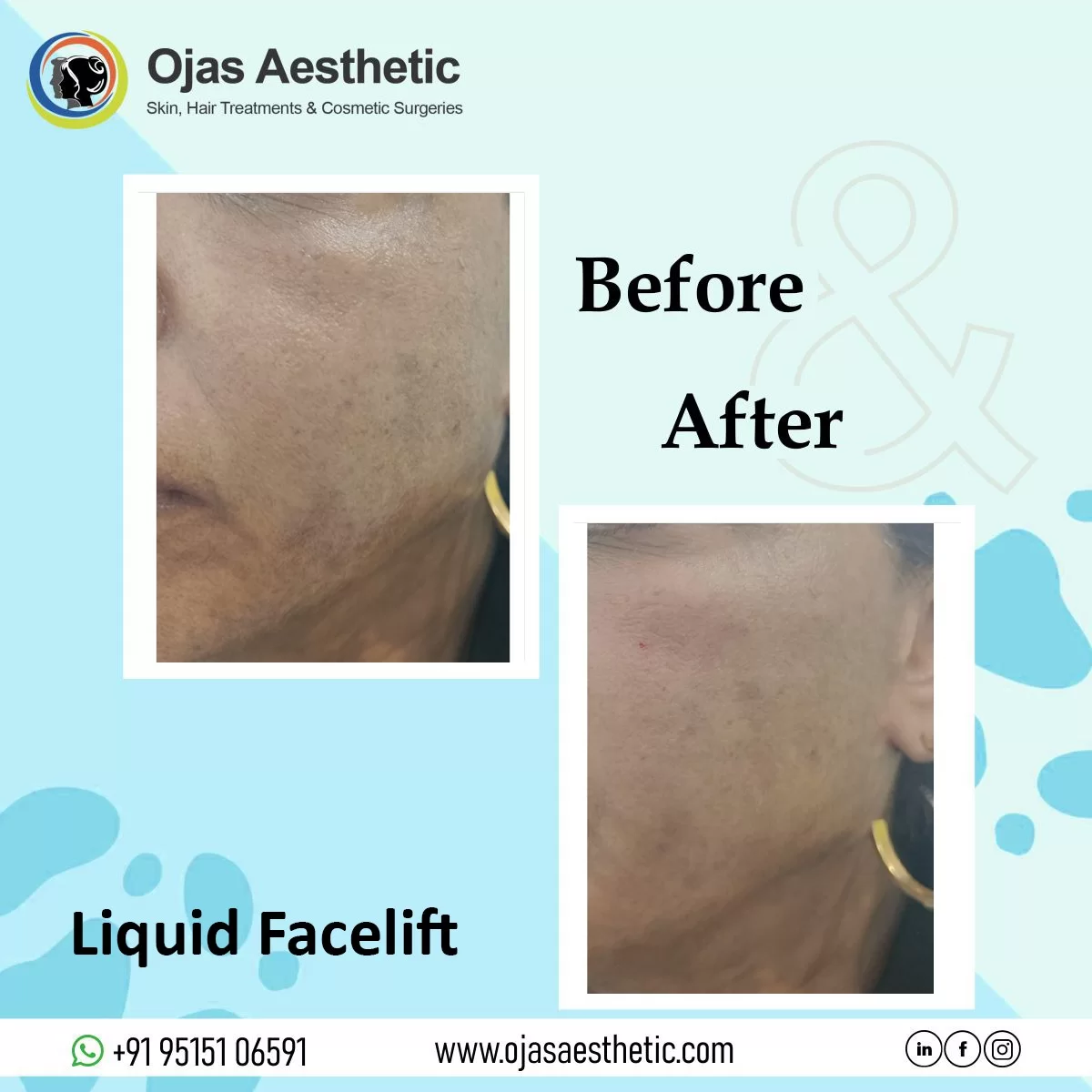 WhatsApp-Image-2023-11-18-at-3.15.07-PM-1