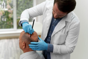 best hair transplant in Hyderabad