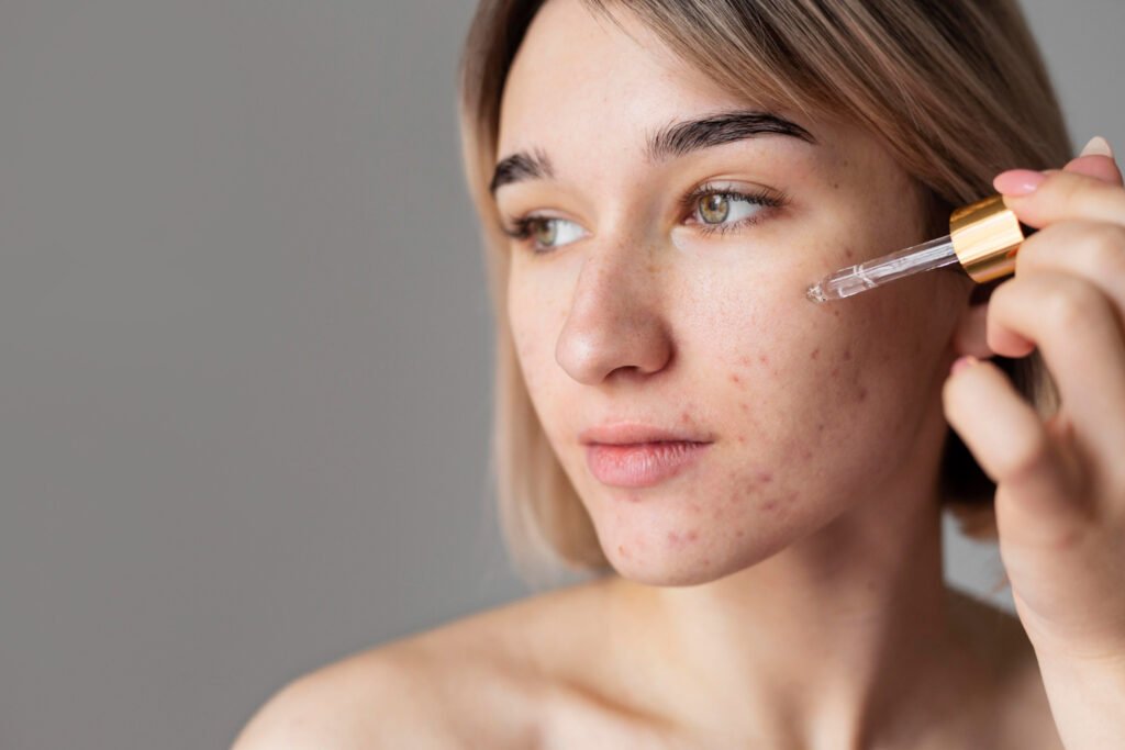 Skin Pigmentation Treatment in Hyderabad