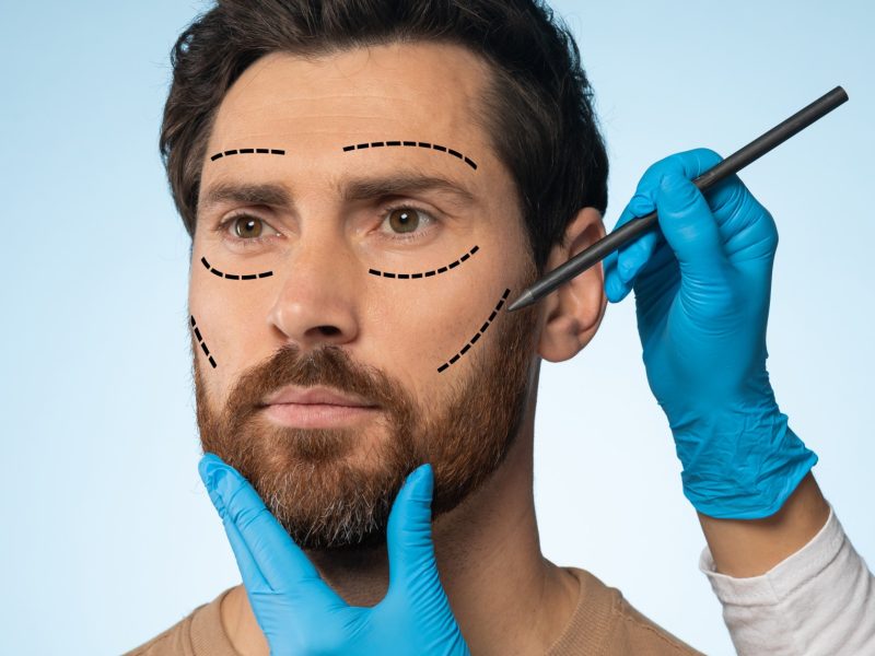 middle-aged-man-getting-pencil-marks-face-skin-cosmetic-surgery-ready-operation-blue-background (1)